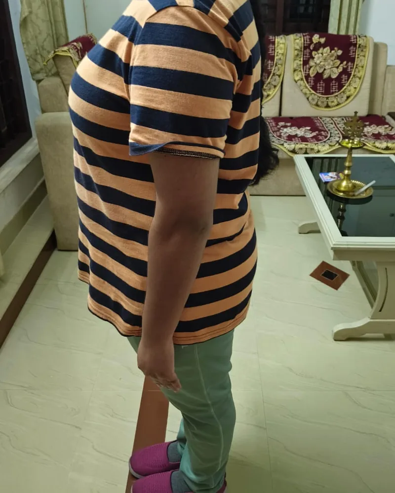 Sneha before her weight-loss journey